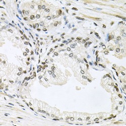 Mitogen-Activated Protein Kinase 8 / JNK1 (MAPK8) Antibody