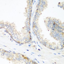 Neural Precursor Cell Expressed, Developmentally Down-Regulated 4, E3 Ubiquitin (NEDD4) Antibody