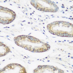 Neural Precursor Cell Expressed, Developmentally Down-Regulated 4, E3 Ubiquitin (NEDD4) Antibody