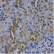 Immunohistochemistry of paraffin-embedded rat kidney using TNFRSF6B antibody (abx000796) at dilution of 1/200 (40x lens).