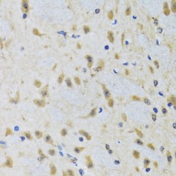 Autophagy Related Protein 7 (ATG7) Antibody