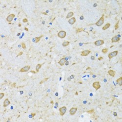 Autophagy Related Protein 7 (ATG7) Antibody