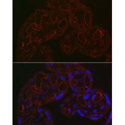 Hematopoietic Progenitor Cell Antigen CD34 (CD34) Antibody