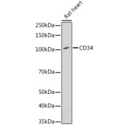 Western blot analysis of extracts of Rat heart lysate, using CD34 Antibody (1/1000 dilution).