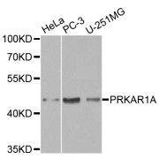 Western blot analysis of extracts of various cell lines, using PRKAR1A antibody (abx000892) at 1/1000 dilution.