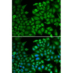 RNA Binding Protein Fox-1 Homolog 3 (RBFOX3) Antibody