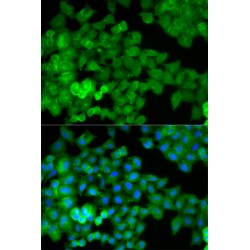 Junction Plakoglobin (JUP) Antibody