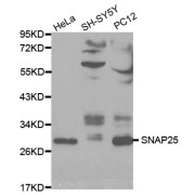 Western blot analysis of extracts of various cell lines, using SNAP25 antibody (abx000939) at 1/1000 dilution.