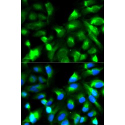 Synaptosomal-Associated Protein 25 (SNAP25) Antibody