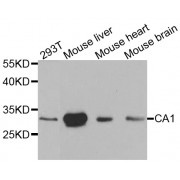 Western blot analysis of extracts of various cell lines, using CA1 antibody (abx000968) at 1/1000 dilution.