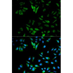 Alpha-Enolase (ENO1) Antibody