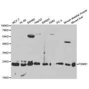 Western blot analysis of extracts of various cell lines, using PSMB1 antibody (abx000971) at 1/1000 dilution.