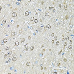 Proteasome Subunit Beta Type 1 (PSMB1) Antibody