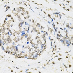 Proteasome Subunit Beta Type 1 (PSMB1) Antibody