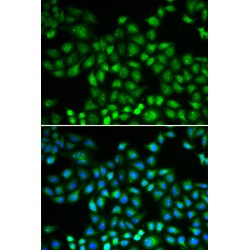 Proteasome Subunit Beta Type 1 (PSMB1) Antibody