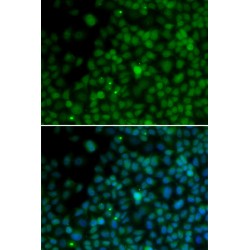 Interferon Regulatory Factor 4 (IRF4) Antibody