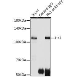 Hexokinase 1 (HK1) Antibody