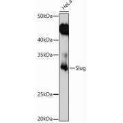 Western blot analysis of extracts of HeLa cell lysates, using SNAI2 antibody (1/1000 dilution).