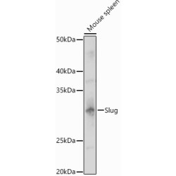 Snail Family Transcriptional Repressor 2 / SLUG (SNAI2) Antibody