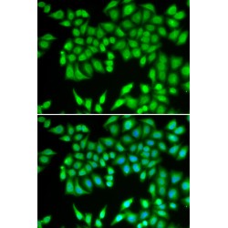 Minichromosome Maintenance Deficient 3 (MCM3) Antibody