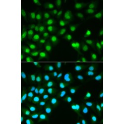 Protein Phosphatase 3 Catalytic Subunit Alpha (PPP3CA) Antibody