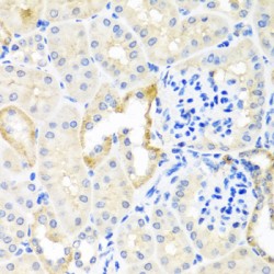 Teratocarcinoma Derived Growth Factor 1 (TDGF1) Antibody