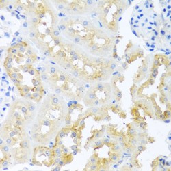 Teratocarcinoma Derived Growth Factor 1 (TDGF1) Antibody