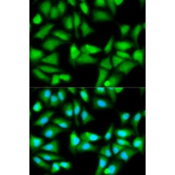 Glutathione Synthetase (GSS) Antibody