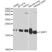 Western blot analysis of extracts of various cell lines, using CSRP1 Antibody (abx000994) at 1/1000 dilution.