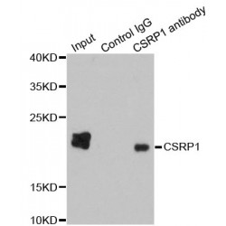 Cysteine And Glycine Rich Protein 1 (CSRP1) Antibody