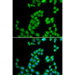 Ribonuclease 13 (RNASE13) Antibody