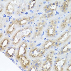 Activating Molecule In BECN1-Regulated Autophagy Protein 1 (AMBRA1) Antibody