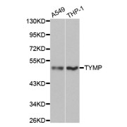 Western blot analysis of extracts of various cell lines, using TYMP antibody (abx001015) at 1/1000 dilution.