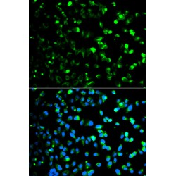 Thymidine Phosphorylase (TYMP) Antibody