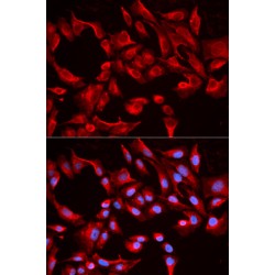 Bcl2 Like Protein 13 (BCL2L13) Antibody