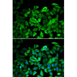 Annexin A1 (ANXA1) Antibody