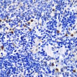 Annexin A1 (ANXA1) Antibody