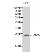 Western blot analysis of extracts of K-562 cells, using RAB7A antibody (abx001068).