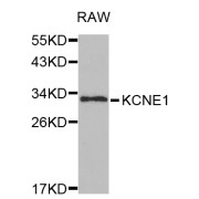 Western blot analysis of extracts of RAW264.7 cells, using KCNE1 antibody (abx001090) at 1/1000 dilution.