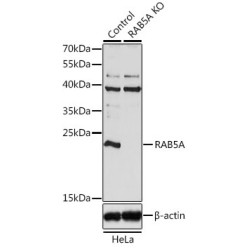 RAB5A, Member RAS Oncogene Family (RAB5A) Antibody