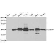 Western blot analysis of extracts of various cell lines, using TARDBP antibody (abx001097) at 1/1000 dilution.