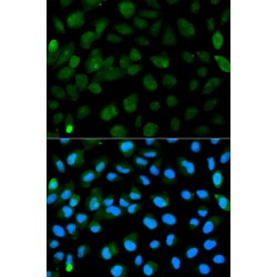 Promyelocytic Leukemia Protein (PML) Antibody