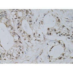 Promyelocytic Leukemia Protein (PML) Antibody