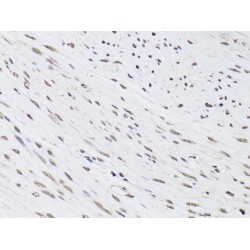 Promyelocytic Leukemia Protein (PML) Antibody