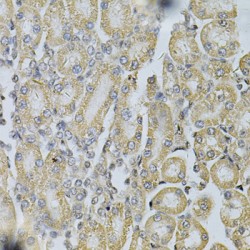 Platelet Derived Growth Factor Subunit B (PDGFB) Antibody