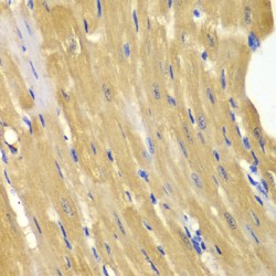 Adenylate Kinase 1 (AK1) Antibody