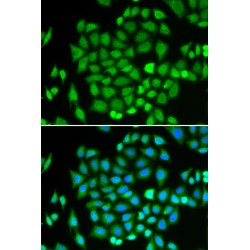 Aflatoxin B1 Aldehyde Reductase Member 2 (AKR7A2) Antibody