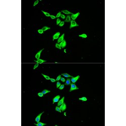 Complement Decay-Accelerating Factor (CD55) Antibody