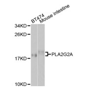 Western blot analysis of extracts of various cell lines, using PLA2G2A antibody (abx001146) at 1/1000 dilution.