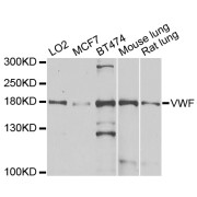 Western blot analysis of extracts of various cell lines, using VWF antibody (abx001191) at 1/1000 dilution.